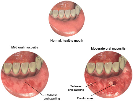 oral rash specialist tyler texas